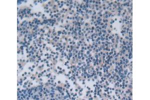 IHC-P analysis of lymph node tissue, with DAB staining.