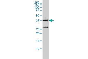 MAGEA2 monoclonal antibody (M01), clone 1H4 Western Blot analysis of MAGEA2 expression in Jurkat . (MAGEA2 antibody  (AA 1-314))