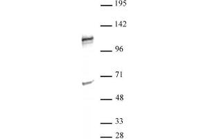 NFATC2 antibody (pAb) tested by Western blot. (NFAT1 antibody  (N-Term))