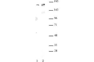 AIB1 antibody (pAb) tested by Western blot. (NCOA3 antibody)