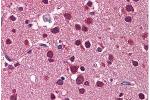 Human Brain, Cortex: Formalin-Fixed, Paraffin-Embedded (FFPE) (LSM1 antibody  (C-Term))
