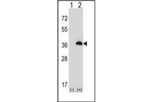 Western blot analysis of PEX16 (arrow) using Peroxin 16 / PEX16 Antibody (Center) Cat. (PEX16 antibody  (Middle Region))