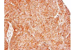 IHC-P Image Immunohistochemical analysis of paraffin-embedded DLD1 xenograft, using TC21, antibody at 1:500 dilution. (RRAS2 antibody  (Center))