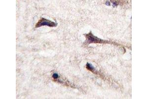IHC analysis of FFPE human brain tissue stained with PKC beta 2 antibody (PKC beta antibody  (AA 642-673))