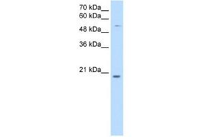 CHIC2 antibody used at 0. (CHIC2 antibody  (N-Term))