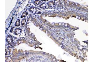 Immunohistochemistry (IHC) image for anti-Fms-Related tyrosine Kinase 3 (FLT3) (AA 62-295) antibody (ABIN5518988)