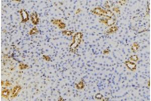 ABIN6279731 at 1/100 staining Mouse kidney tissue by IHC-P. (RAB22A antibody  (C-Term))