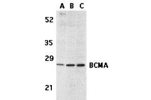 Western Blotting (WB) image for anti-Tumor Necrosis Factor Receptor Superfamily, Member 17 (TNFRSF17) (C-Term) antibody (ABIN1030288)