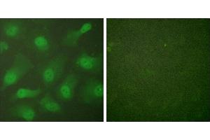 Forskolin + -Immunofluorescence analysis of HeLa cells, treated with Forskolin (40nM, 30mins), using CSantibody. (Exportin 2 antibody)