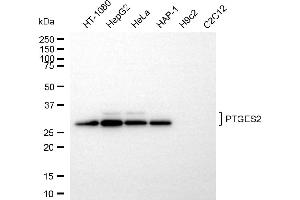 Western blotting analysis using PTGES2 antibody (ABIN7799934).
