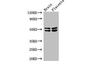 Western Blot Positive WB detected in: Mouse brain tissue, Human placenta tissue All lanes: ADRB1 antibody at 3 μg/mL Secondary Goat polyclonal to rabbit IgG at 1/50000 dilution Predicted band size: 52 kDa Observed band size: 52, 48 kDa (ADRB1 antibody  (AA 401-477))