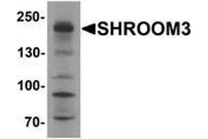 Western blot analysis of SHROOM3 in SK-N-SH cell lysate with SHROOM3 Antibody at 1 μg/ml (SHROOM3 antibody  (Middle Region))