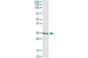 Immunoprecipitation of NME5 transfected lysate using anti-NME5 MaxPab rabbit polyclonal antibody and Protein A Magnetic Bead , and immunoblotted with NME5 purified MaxPab mouse polyclonal antibody (B01P) . (NME5 antibody  (AA 1-212))