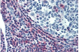 Immunohistochemistry staining of human tonsil (paraffin sections) using anti-CD50 (MEM-04). (ICAM-3/CD50 antibody)