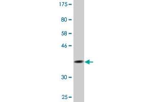 Western Blot detection against Immunogen (36. (GS28 antibody  (AA 2-100))
