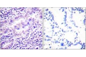 Immunohistochemistry (IHC) image for anti-Protein Phosphatase 2, Catalytic Subunit, alpha Isozyme (PPP2CA) (AA 260-309), (pTyr307) antibody (ABIN1531377)