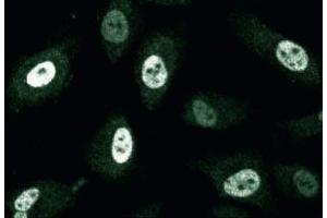 Immunofluorescence staining of human endothelial cells. (CENPF antibody  (AA 209-381))