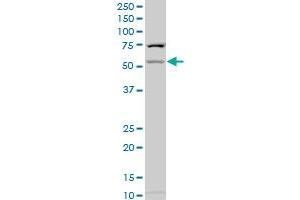 CHST2 polyclonal antibody (A01), Lot # 060524JCS1 Western Blot analysis of CHST2 expression in HepG2 . (CHST2 antibody  (AA 431-530))