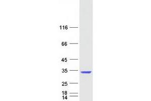 Western Blotting (WB) image for Phosphatase, Orphan 1 (PHOSPHO1) protein (Myc-DYKDDDDK Tag) (ABIN2712344)
