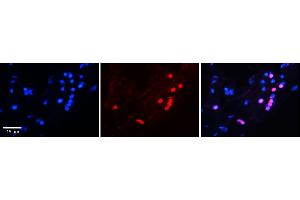 Rabbit Anti-FOXA1 antibody  Catalog Number: ARP32630_P050 Formalin Fixed Paraffin Embedded Tissue: Human Adult heart  Observed Staining: Nuclei in adipocytes but not in cardiomyocytes Primary Antibody Concentration: 1:100 Secondary Antibody: Donkey anti-Rabbit-Cy2/3 Secondary Antibody Concentration: 1:200 Magnification: 20X Exposure Time: 0. (FOXA1 antibody  (C-Term))