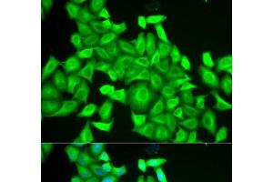 Immunofluorescence analysis of HeLa cells using RAB6A Polyclonal Antibody (RAB6A antibody)