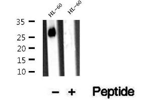 Western blot analysis of extracts of HL-60 cells, using ARHGDIB antibody. (ARHGDIB antibody  (N-Term))