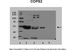 Sample Type: 1. (COPS2 antibody  (N-Term))