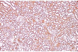 Immunohistochemistry of paraffin-embedded Human kidney using CDK4 Polyclonal Antibody at dilution of 1:100 (CDK4 antibody)