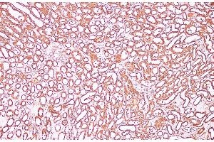 Immunohistochemistry of paraffin-embedded Human kidney using CDK4 Polyclonal Antibody at dilution of 1:100