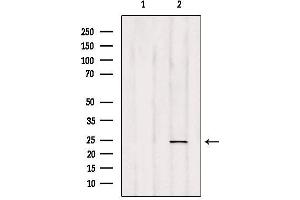 Western blot analysis of extracts from HepG2, using RAB35 Antibody.
