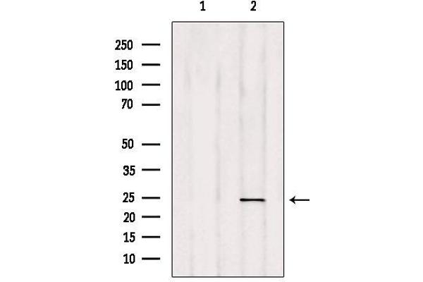 RAB35 antibody  (Internal Region)
