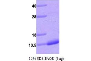 SDS-PAGE (SDS) image for S100 Calcium Binding Protein A4 (S100A4) (AA 1-101) protein (His tag) (ABIN667107) (s100a4 Protein (AA 1-101) (His tag))