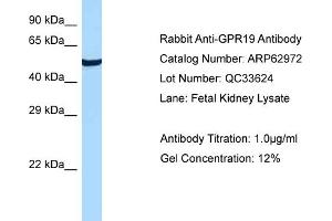 Western Blotting (WB) image for anti-G Protein-Coupled Receptor 19 (GPR19) (C-Term) antibody (ABIN970810) (GPR19 antibody  (C-Term))