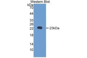 Detection of Recombinant RBP5, Rat using Monoclonal Antibody to Retinol Binding Protein 5, Cellular (RBP5) (Retinol Binding Protein 5 antibody  (AA 19-201))