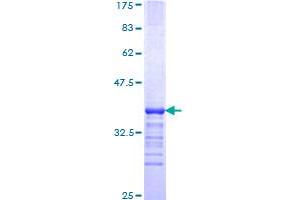 Image no. 1 for Kruppel-Like Factor 3 (Basic) (KLF3) (AA 1-69) protein (GST tag) (ABIN1308752) (KLF3 Protein (AA 1-69) (GST tag))