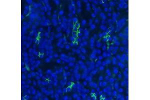 IF analysis of SLC12A1 using anti-SLC12A1 antibody (ABIN3043925).
