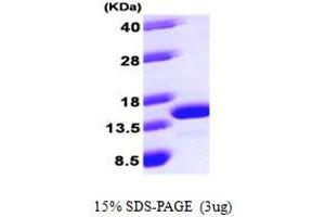 SDS-PAGE (SDS) image for Late Endosomal/lysosomal Adaptor, MAPK and mTOR Activator 2 (LAMTOR2) (AA 1-125) protein (His tag) (ABIN667853) (LAMTOR2 Protein (AA 1-125) (His tag))