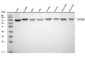 Western blot analysis of TOP3B using anti-TOP3B antibody (ABIN7599907).