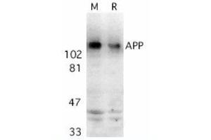 Image no. 1 for anti-Amyloid beta (A4) Precursor Protein (APP) (AA 737-751) antibody (ABIN319013)