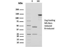 SDS-PAGE Analysis Purified PAPP-A Mouse Monoclonal Antibody (PAPPA/2718).