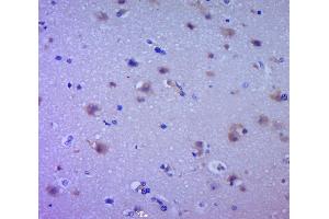 Paraformaldehyde-fixed, paraffin embedded human brain glioma, Antigen retrieval by boiling in sodium citrate buffer (pH6.