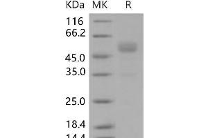 FZD10 Protein (Fc Tag)
