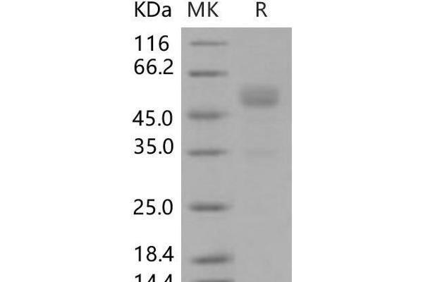 FZD10 Protein (Fc Tag)