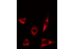 ABIN6274634 staining Hela cells by IF/ICC. (CYP17A1 antibody  (Internal Region))