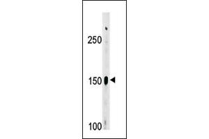 Image no. 1 for anti-ABL2 (ABL2) (Middle Region) antibody (ABIN358072) (ABL2 antibody  (Middle Region))