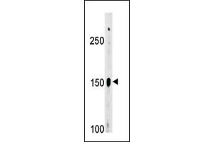 Image no. 1 for anti-ABL2 (ABL2) (Middle Region) antibody (ABIN358072)