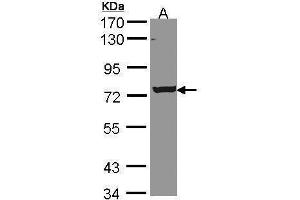 WB Image Sample (30 ug of whole cell lysate) A: A431 , 7. (C9orf96 antibody  (C-Term))