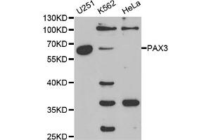 Western blot analysis of extracts of various cell lines, using PAX3 antibody (ABIN5970834) at 1/1000 dilution. (Paired Box 3 antibody)