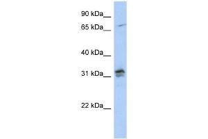 H1FOO antibody used at 1 ug/ml to detect target protein. (H1FOO antibody  (N-Term))