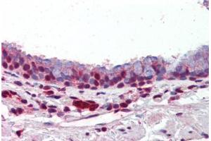Human Lung, Respiratory Epithelium (formalin-fixed, paraffin-embedded) stained with PRMT1 antibody ABIN462306 followed by biotinylated goat anti-rabbit IgG secondary antibody ABIN481713, alkaline phosphatase-streptavidin and chromogen. (PRMT1 antibody  (AA 317-346))